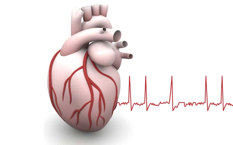 What is AFib?