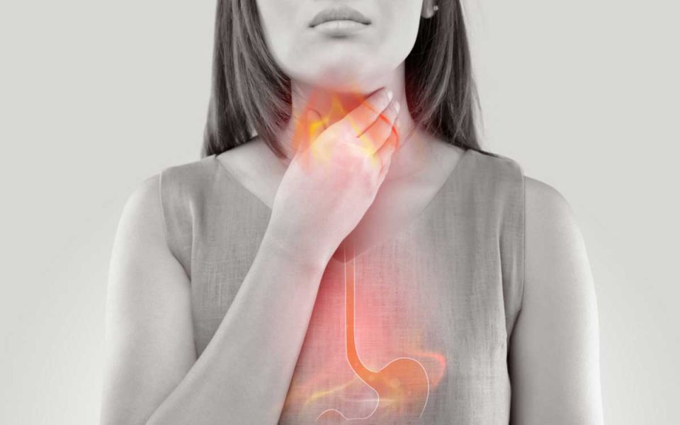 The Effects of Long-Term GERD