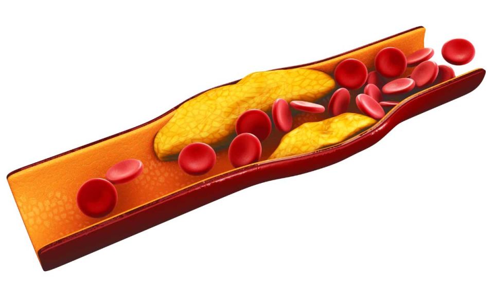 PCSK9: The Real Problem Behind Cholesterol