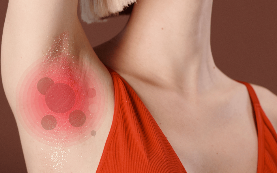 Modern Medicine is Transforming Hidradenitis Suppurativa Treatment